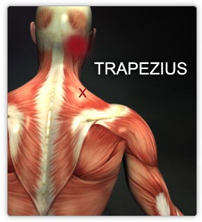 trapezius